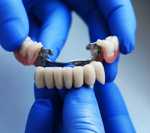 Aurora Dental Bridges