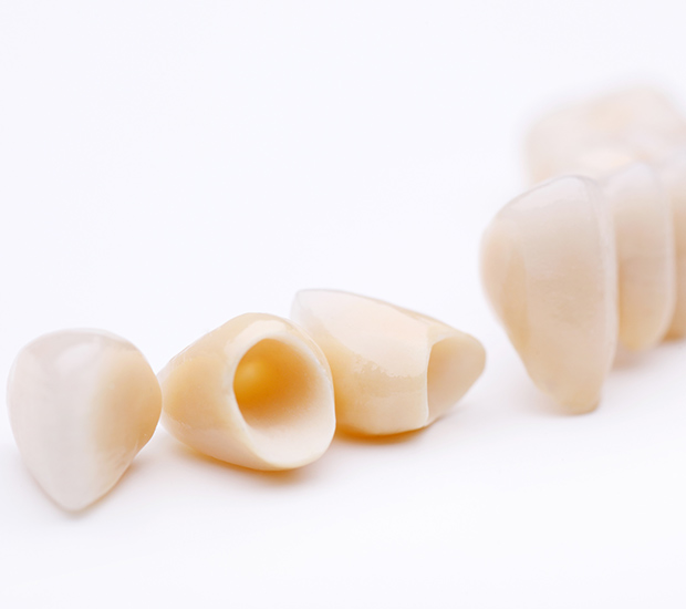 Aurora Dental Crowns and Dental Bridges