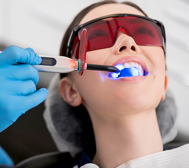 Aurora Professional Teeth Whitening