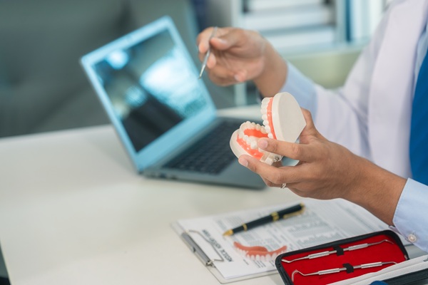 FAQs About Tooth Colored Fillings